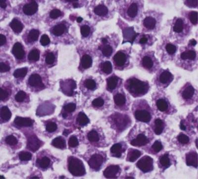 Cellule staminali del sangue