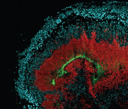 Organoidi, nuova dimensione dei modelli cellulari
