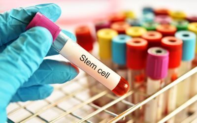 cellule staminali, parkinson, STEM-PD