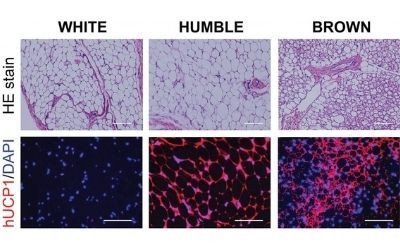 Immagini al microscopio dei vari tipi di tessuti grassi sviluppati nei topi dopo il trapianto - Crediti: Joslin Diabetes Center