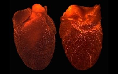 Rigenerazione cardiaca