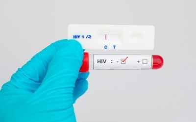 HIV