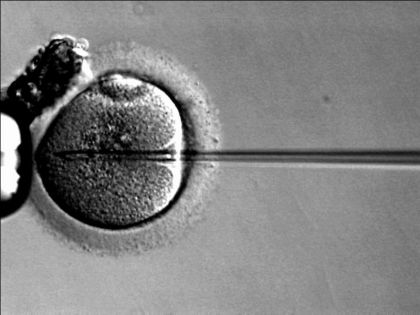 gene della microdistrofina