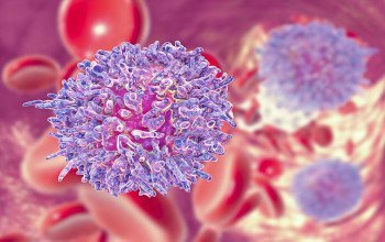 Leucemia