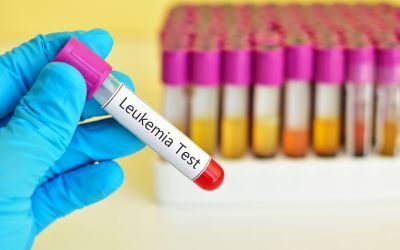 leucemia, crispr, sherlock