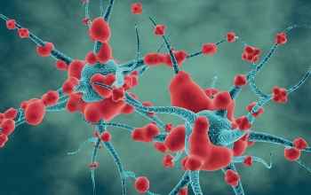 Malattia neurodegenerativa