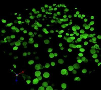 This image shows fluorescently labeled mesenchymal stem cells (MSC) in a hyaluronic acid hydrogel. 