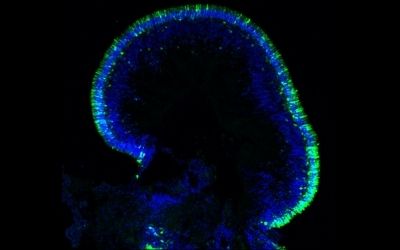 Organoide retinico