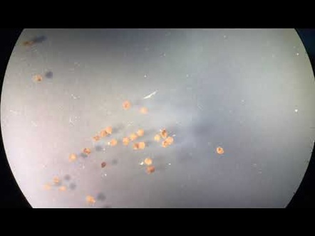 Osservatorio Terapie Avanzate - Video